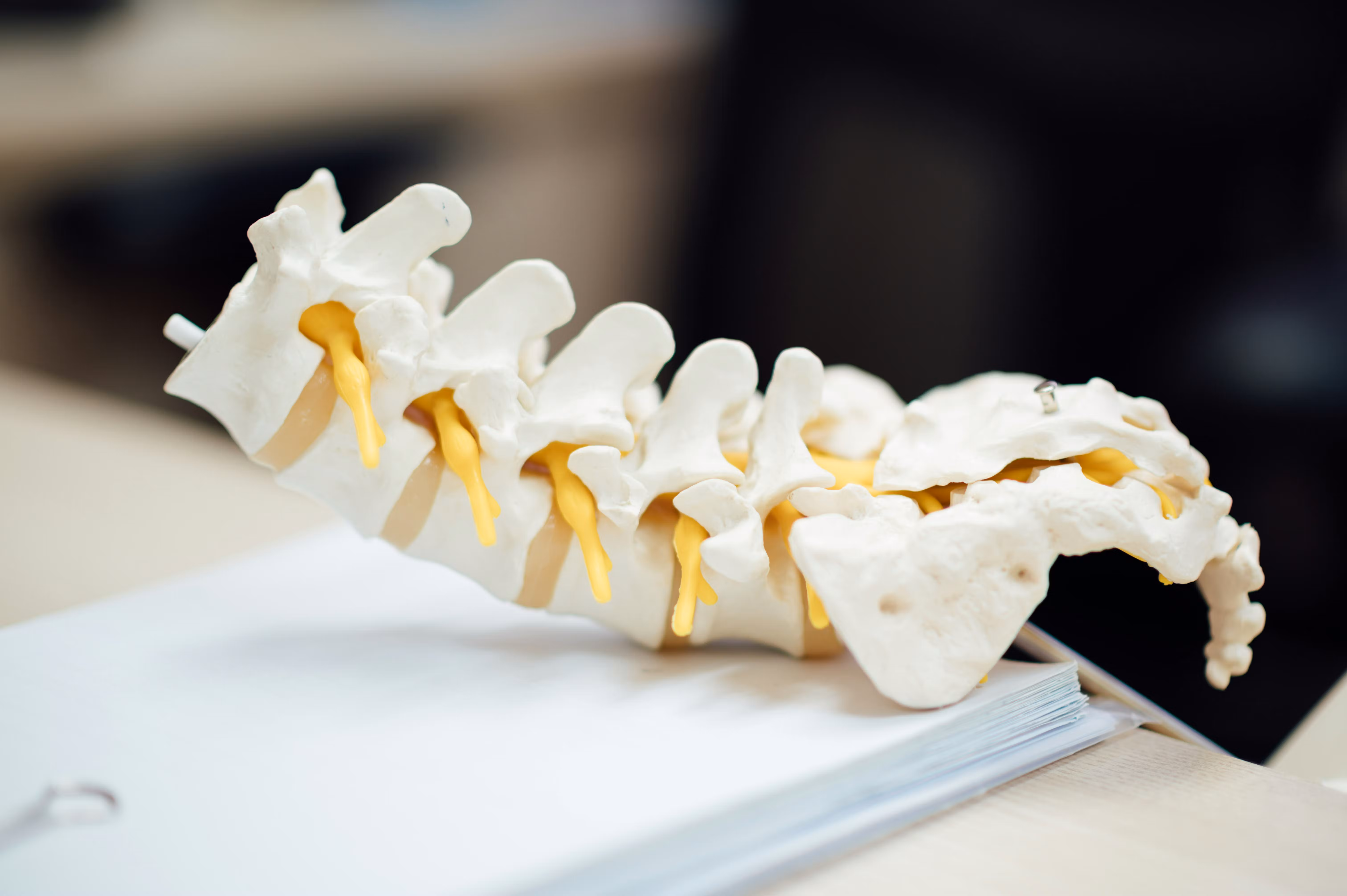 Spondylosis Treatment