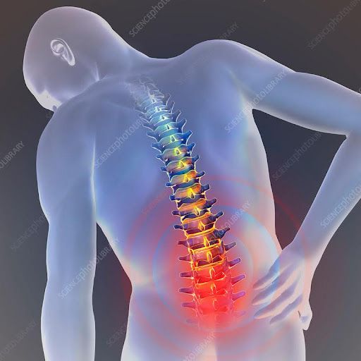 Chronic Lower Back Pain